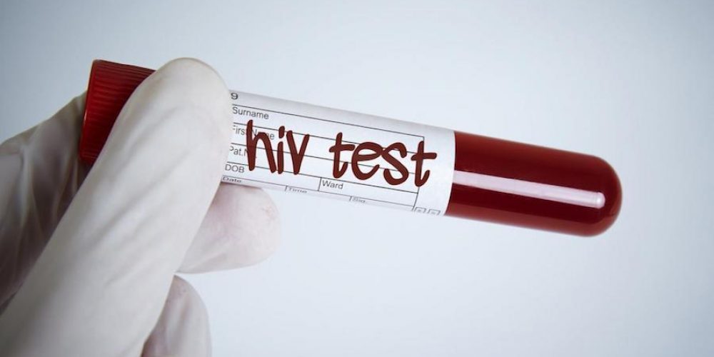 Coronavirus: que lecciones nos dejó el sida, la «peor pandemia de finales del siglo XX», para hacer frente al covid-19