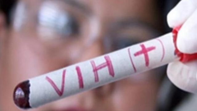 Logran eliminar el VIH en seis pacientes gracias al trasplante de células madre